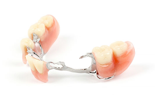 Ottawa Denture & Implant Centre Partial Dentures